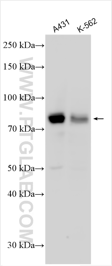 Western Blot (WB) analysis of various lysates using RPS6KA1 Polyclonal antibody (29224-1-AP)