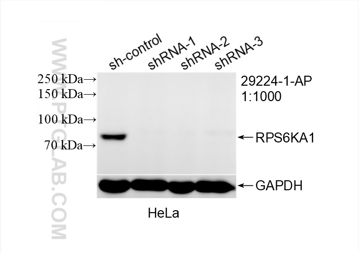 Western Blot (WB) analysis of HeLa cells using RPS6KA1 Polyclonal antibody (29224-1-AP)