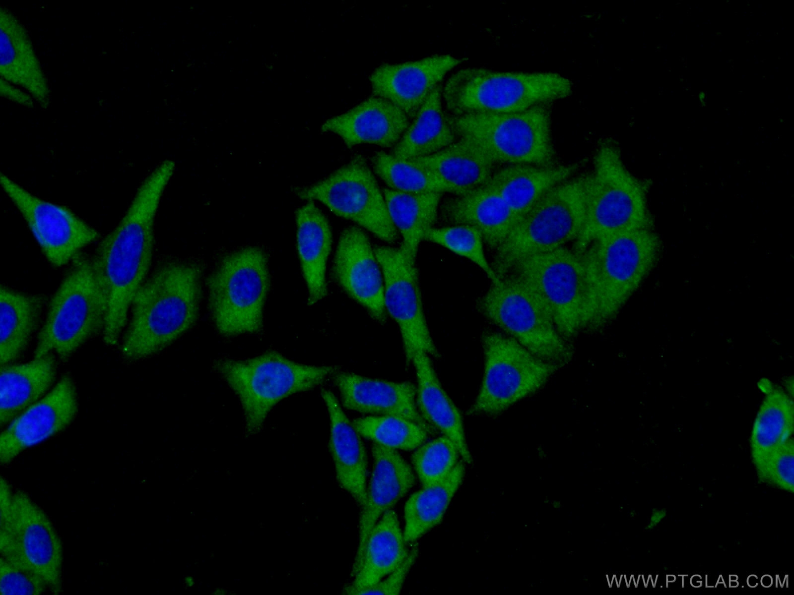 Immunofluorescence (IF) / fluorescent staining of HepG2 cells using RSK2 Polyclonal antibody (23762-1-AP)