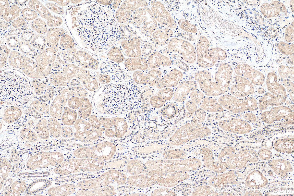 Immunohistochemistry (IHC) staining of human kidney tissue using RSK2 Polyclonal antibody (23762-1-AP)