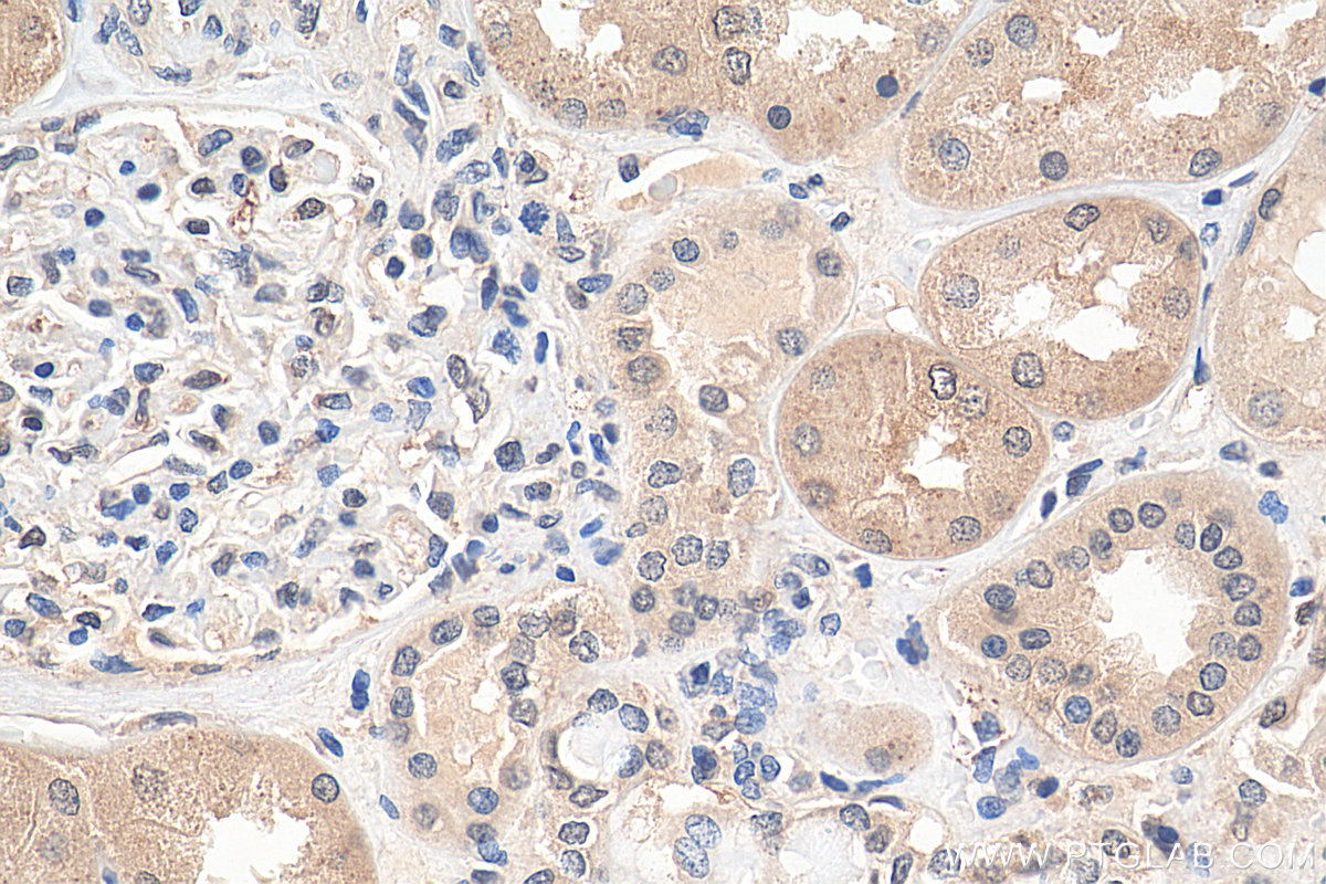 Immunohistochemistry (IHC) staining of human kidney tissue using RSK2 Polyclonal antibody (23762-1-AP)