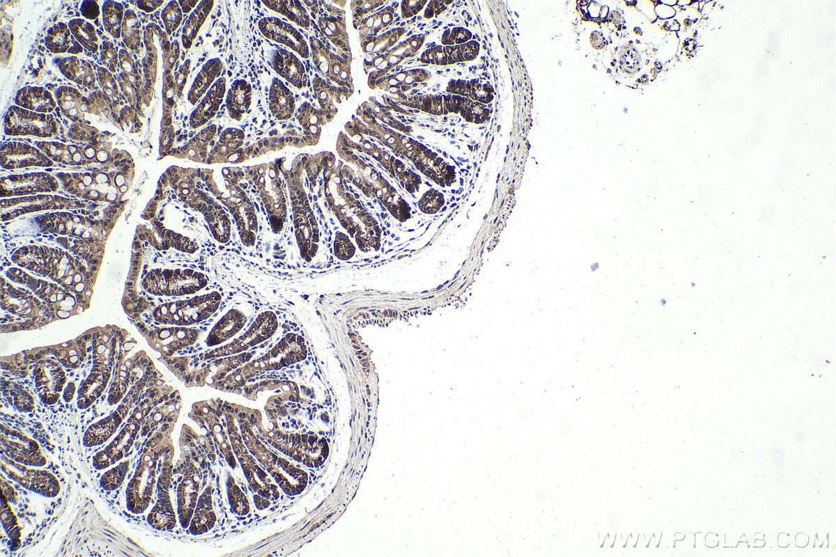 Immunohistochemistry (IHC) staining of mouse colon tissue using RSK2 Polyclonal antibody (23762-1-AP)