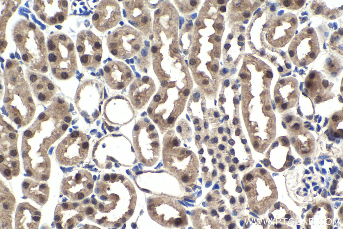 Immunohistochemistry (IHC) staining of mouse kidney tissue using RSK2 Polyclonal antibody (23762-1-AP)