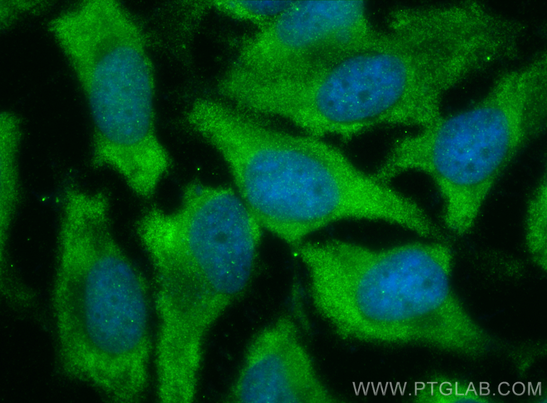 Immunofluorescence (IF) / fluorescent staining of HeLa cells using RPS9 Polyclonal antibody (18215-1-AP)