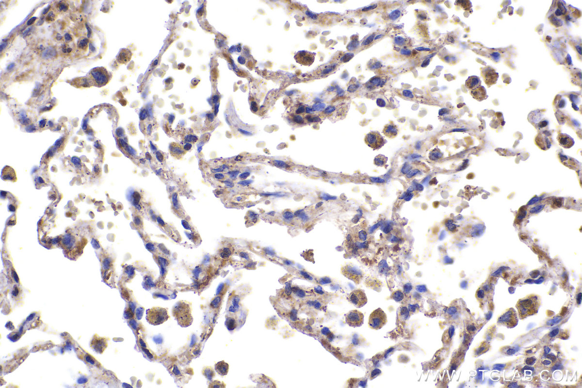 Immunohistochemistry (IHC) staining of human lung tissue using RPS9 Polyclonal antibody (18215-1-AP)