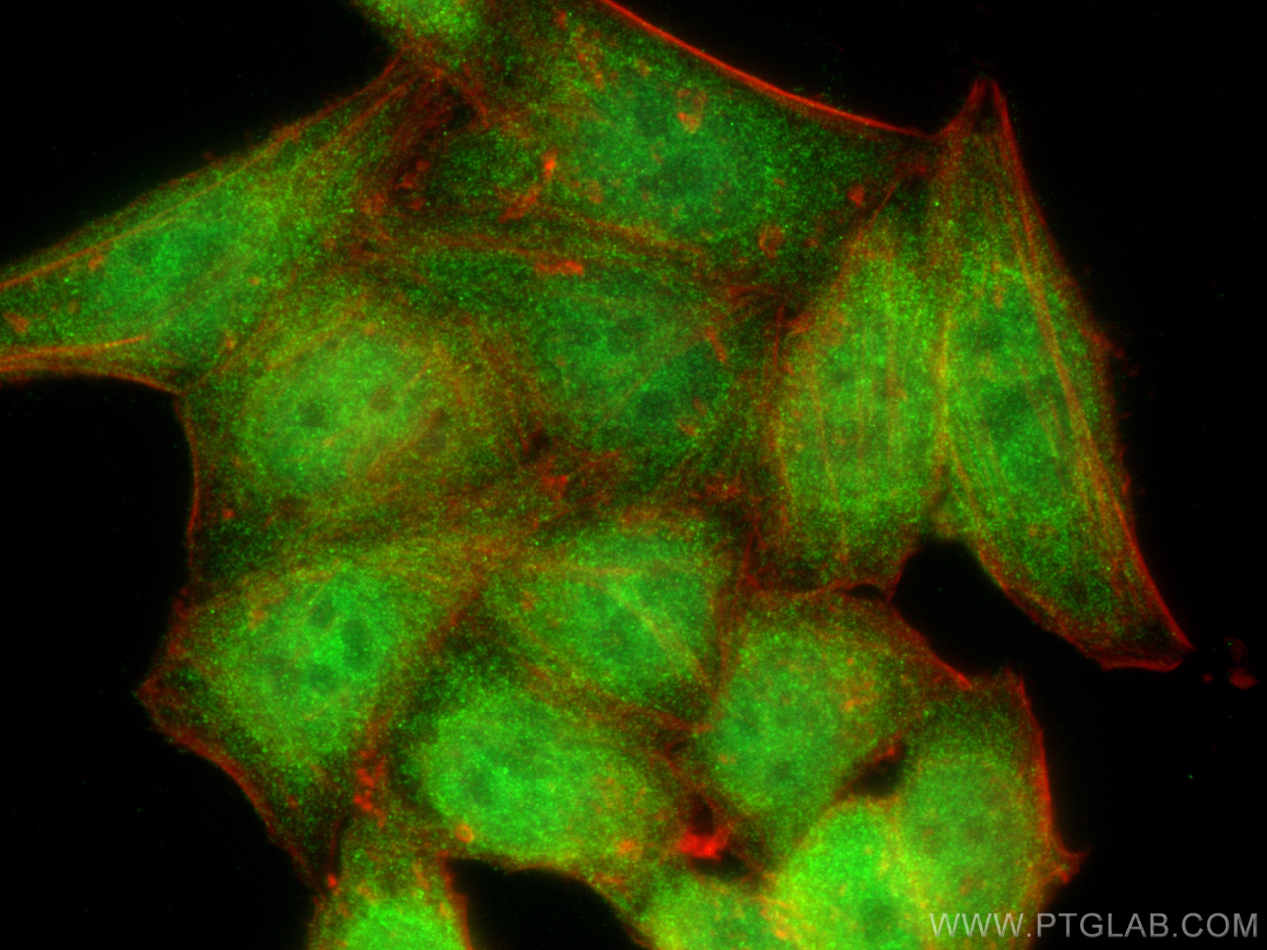 Immunofluorescence (IF) / fluorescent staining of HepG2 cells using CNOT9 Polyclonal antibody (22503-1-AP)
