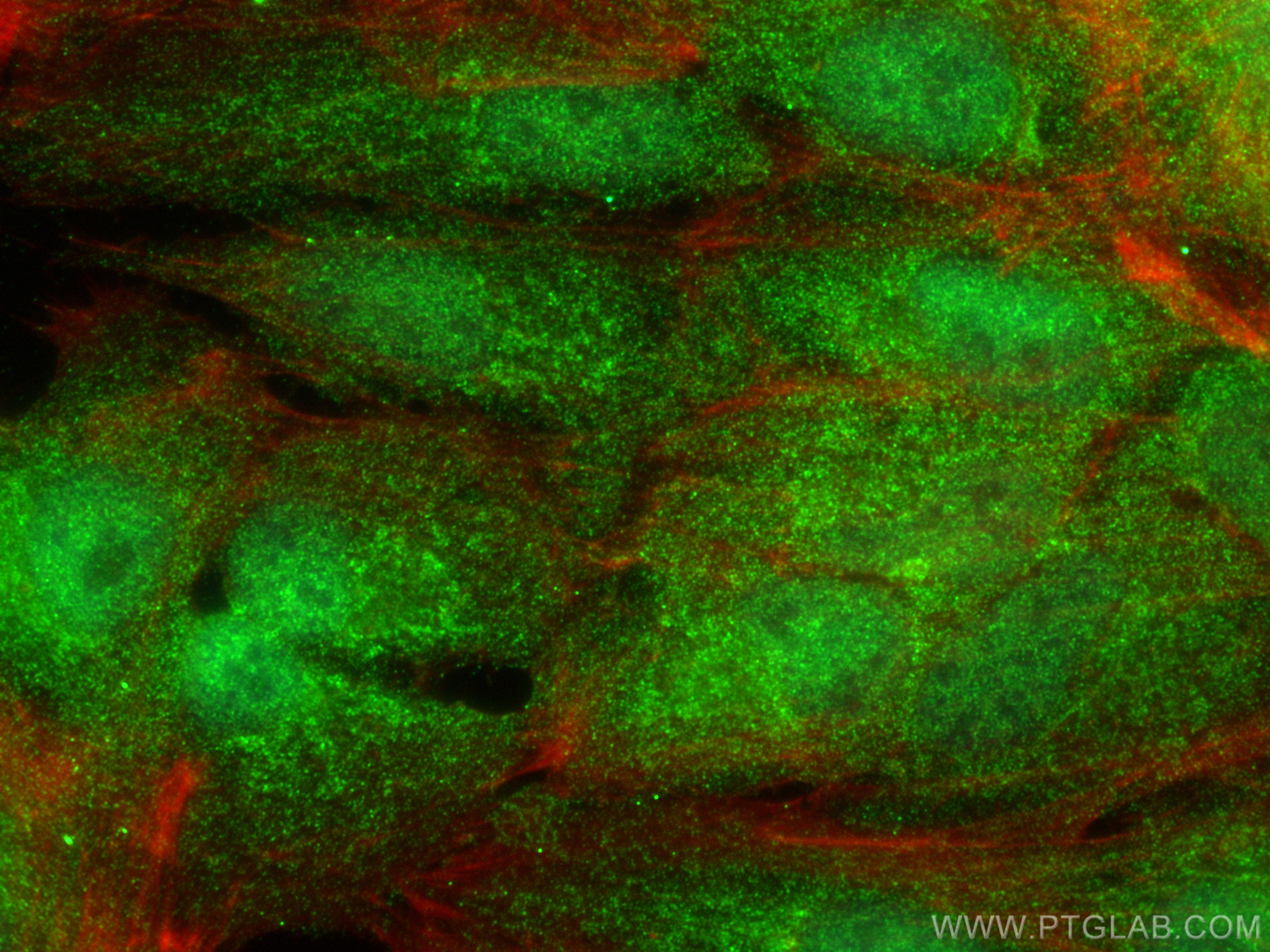 Immunofluorescence (IF) / fluorescent staining of hTERT-RPE1 cells using CNOT9 Polyclonal antibody (22503-1-AP)