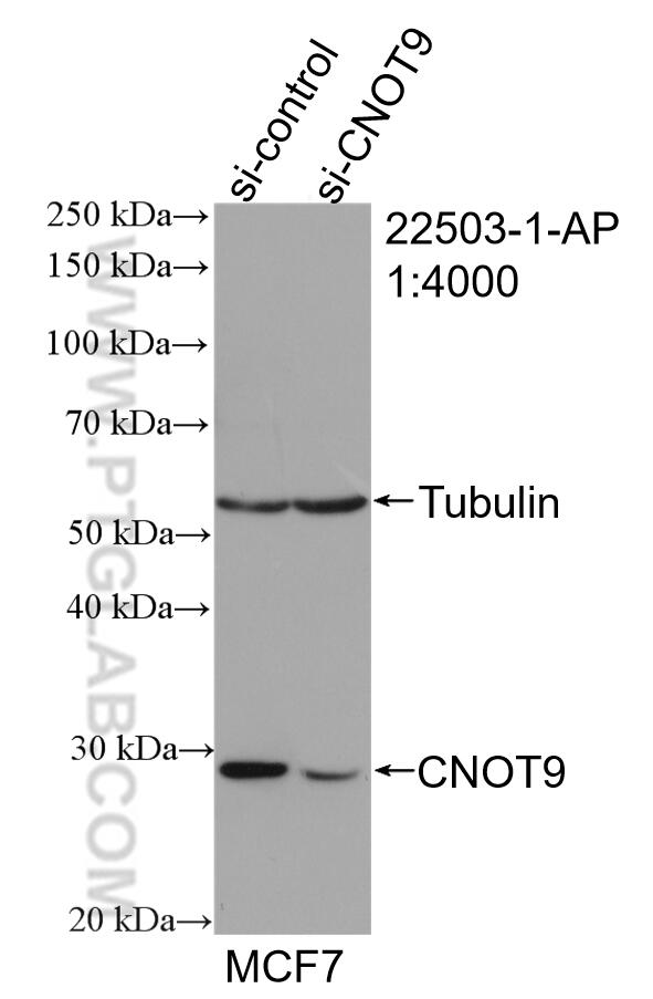 Western Blot (WB) analysis of MCF-7 cells using CNOT9 Polyclonal antibody (22503-1-AP)