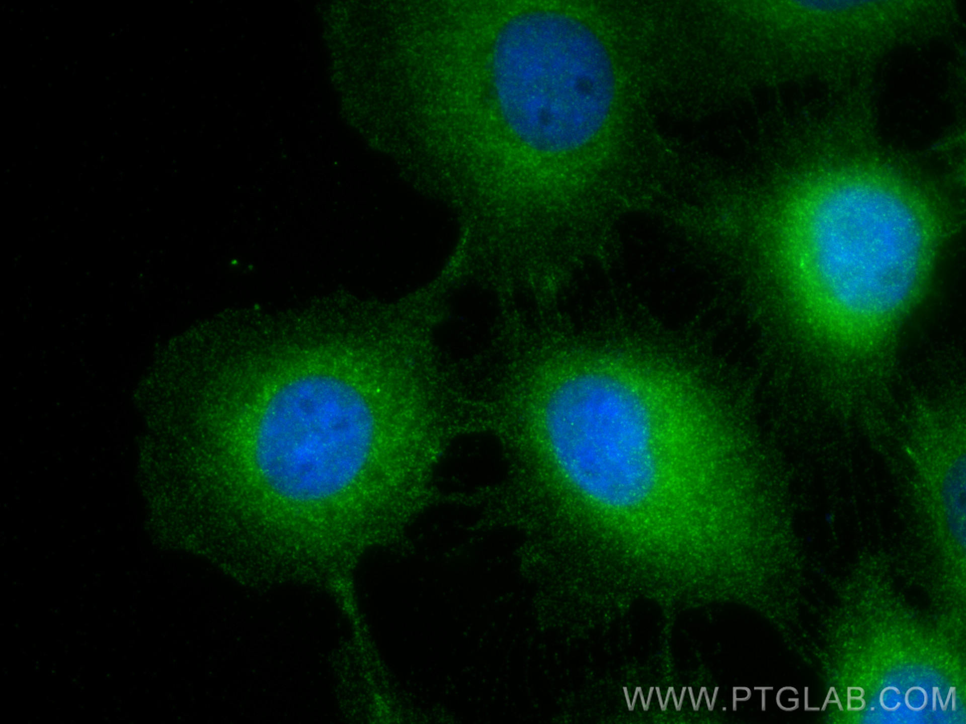 Immunofluorescence (IF) / fluorescent staining of A431 cells using RRAS2 Polyclonal antibody (12530-1-AP)