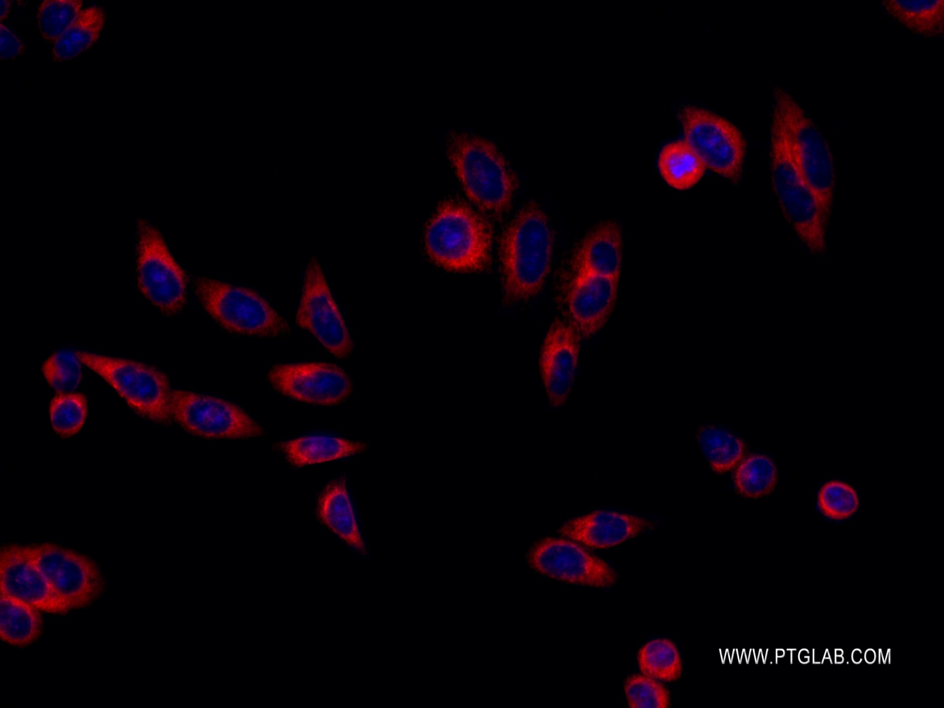 Immunofluorescence (IF) / fluorescent staining of HepG2 cells using RRBP1 Recombinant antibody (82890-2-RR)