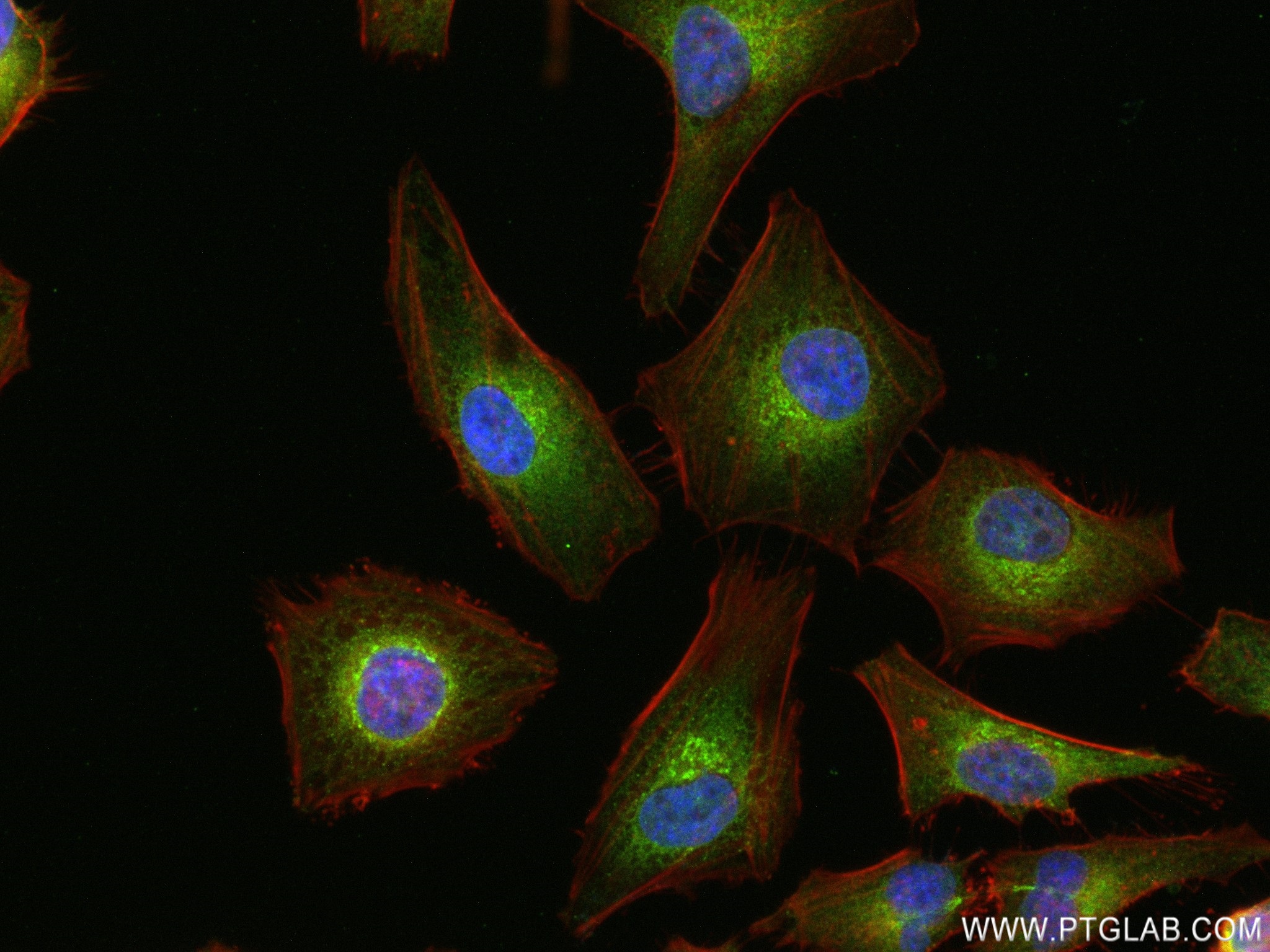 Immunofluorescence (IF) / fluorescent staining of HeLa cells using RRBP1 Recombinant antibody (82890-3-RR)