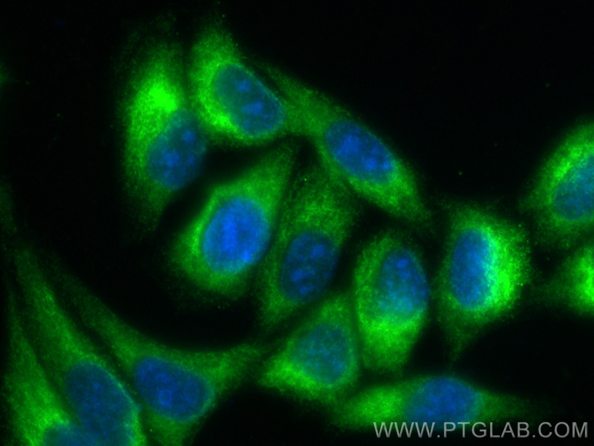 Immunofluorescence (IF) / fluorescent staining of HepG2 cells using CoraLite® Plus 488-conjugated RRBP1 Recombinant an (CL488-82890-3)