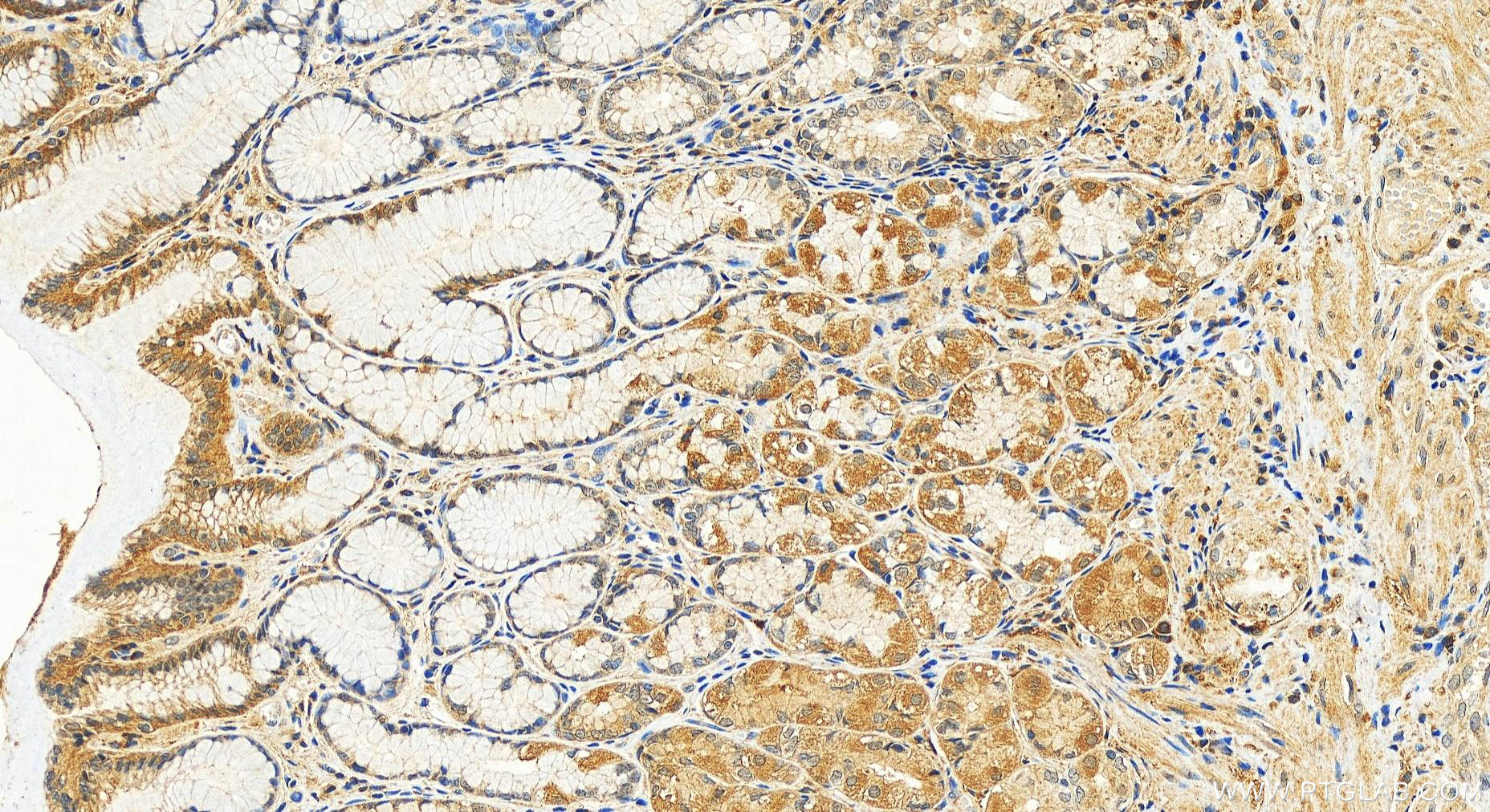 Immunohistochemistry (IHC) staining of human stomach tissue using RREB1-Specific Polyclonal antibody (20280-1-AP)