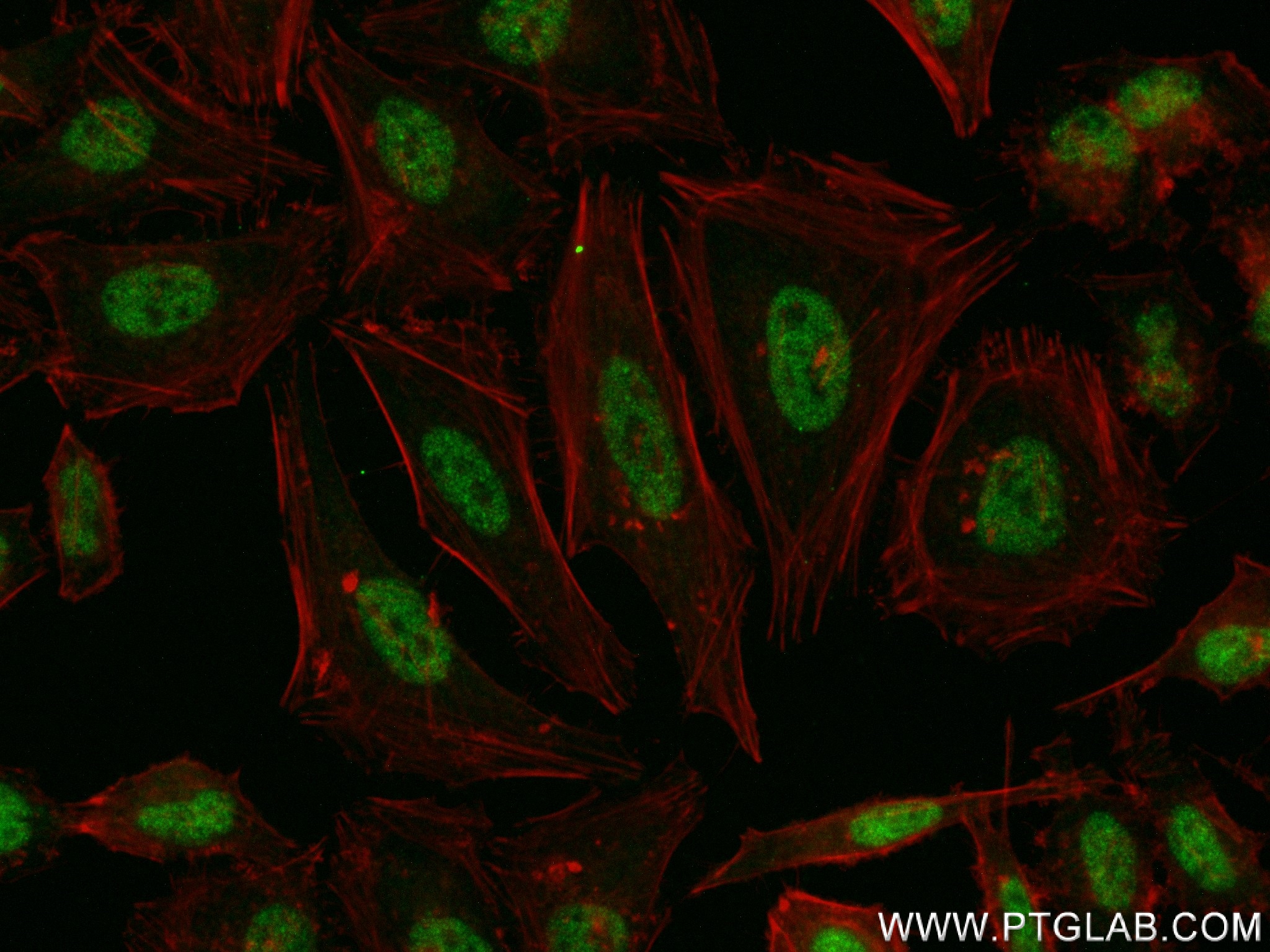 RREB1-Specific