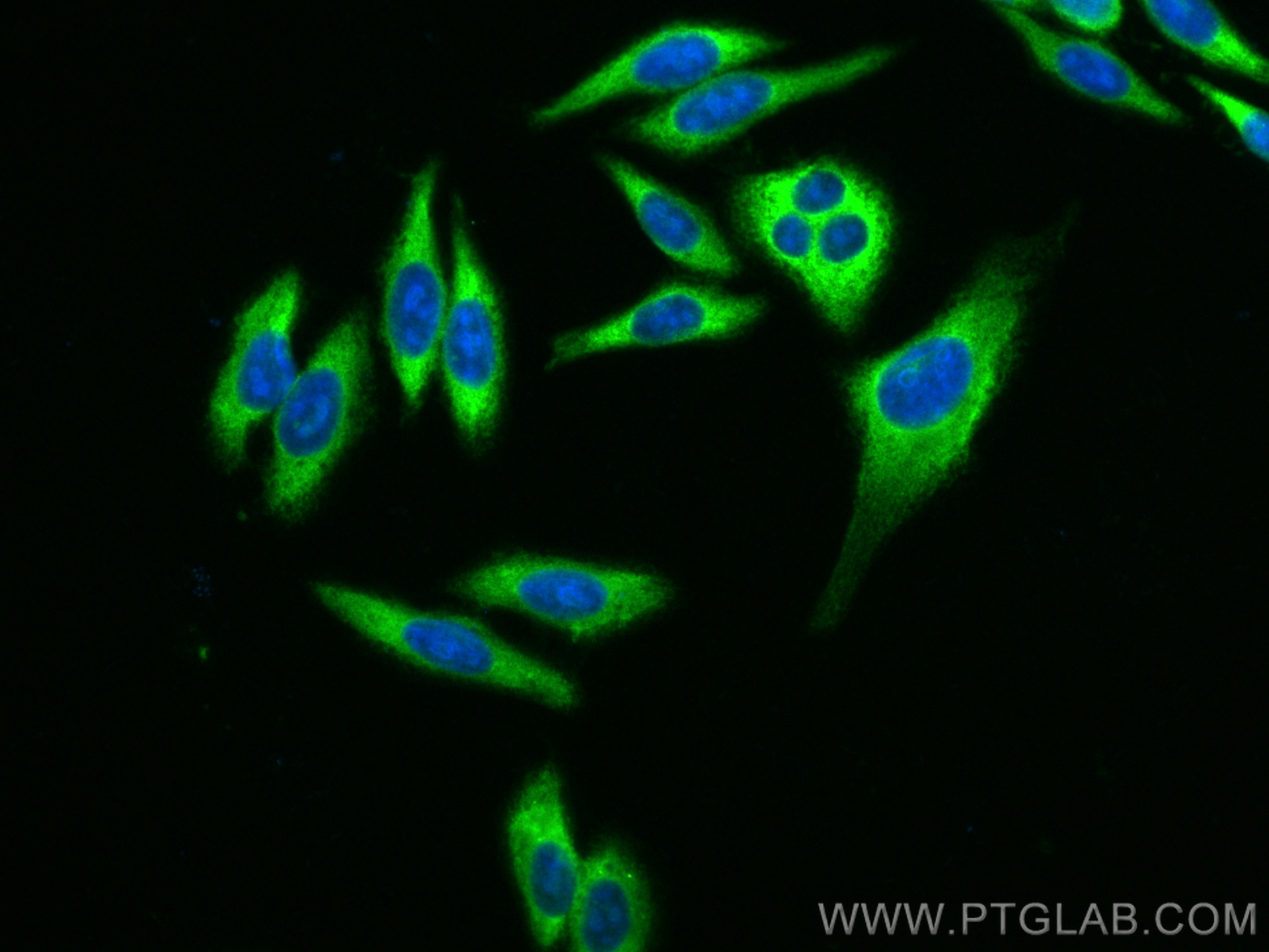 Immunofluorescence (IF) / fluorescent staining of HepG2 cells using CoraLite® Plus 488-conjugated RRM1 Monoclonal anti (CL488-60073)