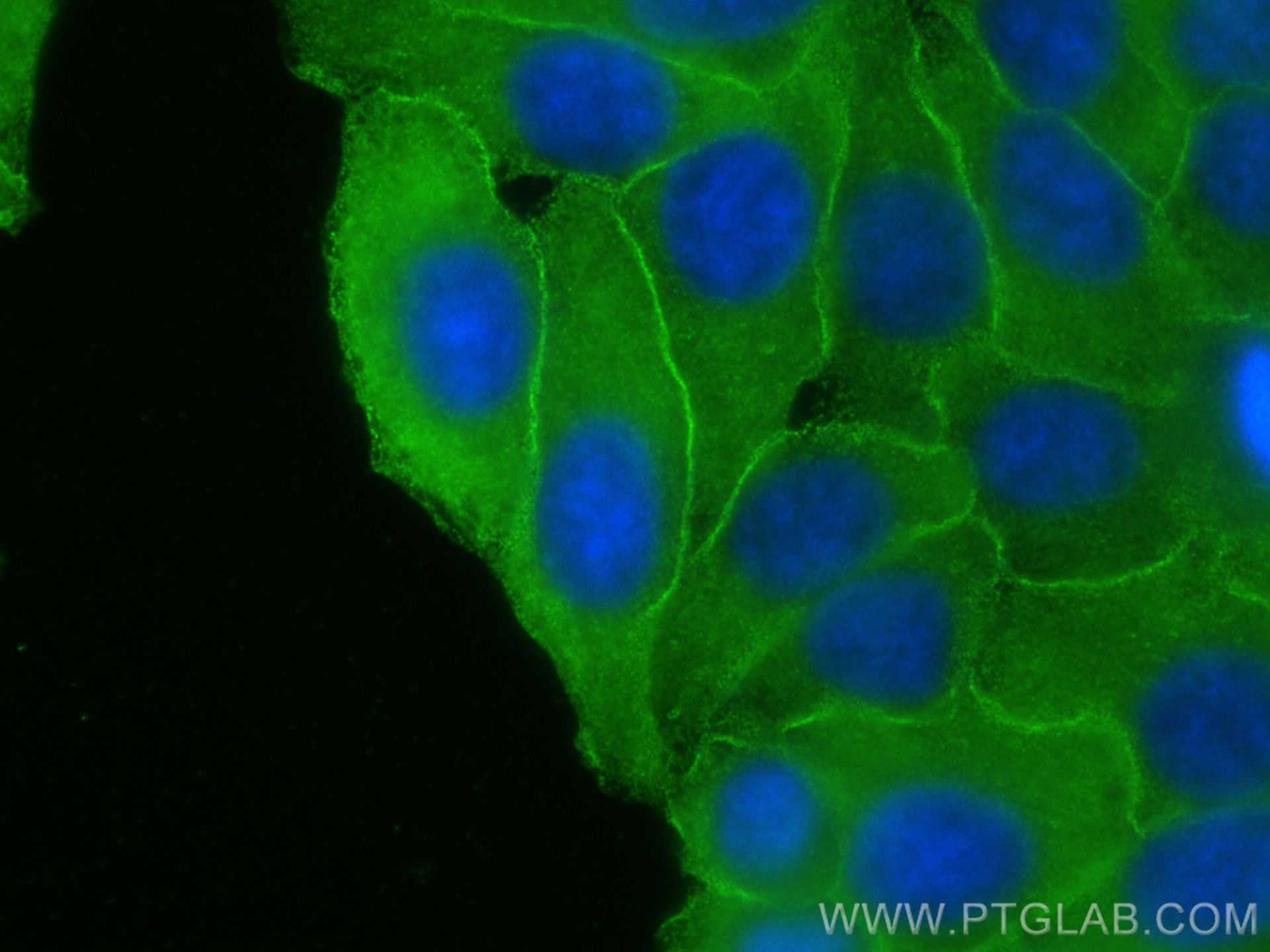 Immunofluorescence (IF) / fluorescent staining of HepG2 cells using RRM2 Monoclonal antibody (67006-1-Ig)