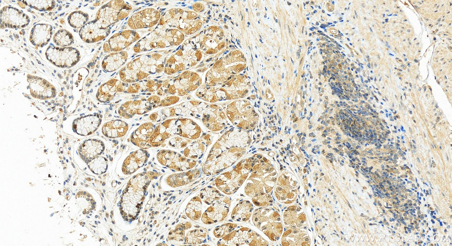 Immunohistochemistry (IHC) staining of human stomach tissue using RRM2B,p53R2 Polyclonal antibody (18005-1-AP)