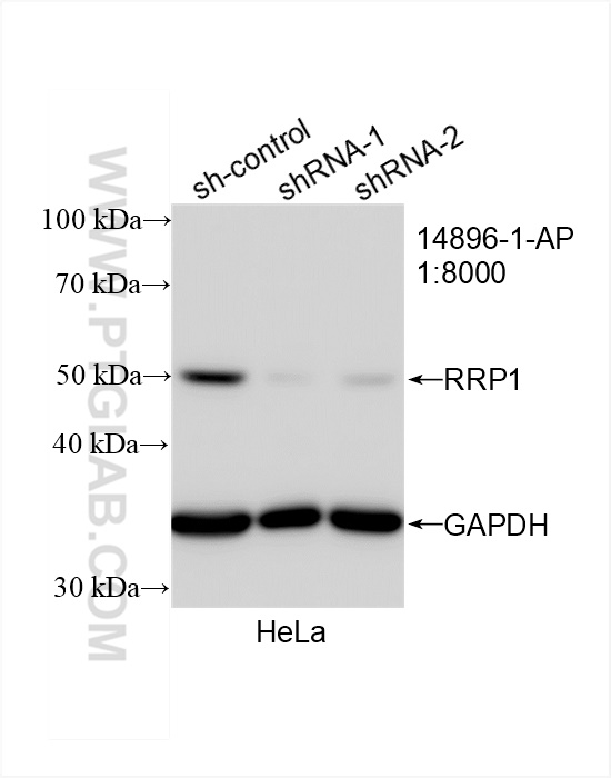 Western Blot (WB) analysis of HeLa cells using RRP1 Polyclonal antibody (14896-1-AP)