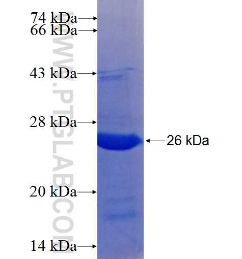 RRP12 fusion protein Ag25278 SDS-PAGE