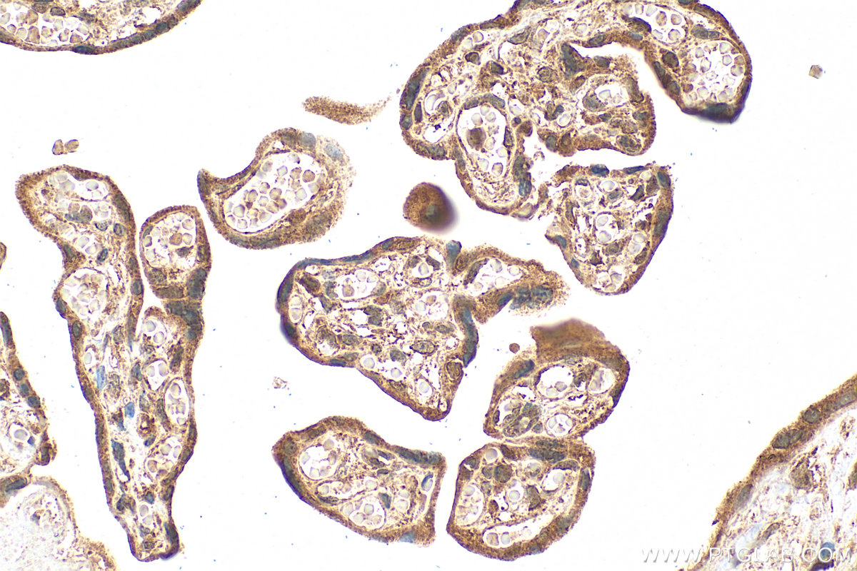 Immunohistochemistry (IHC) staining of human placenta tissue using RRP7A Polyclonal antibody (24490-1-AP)