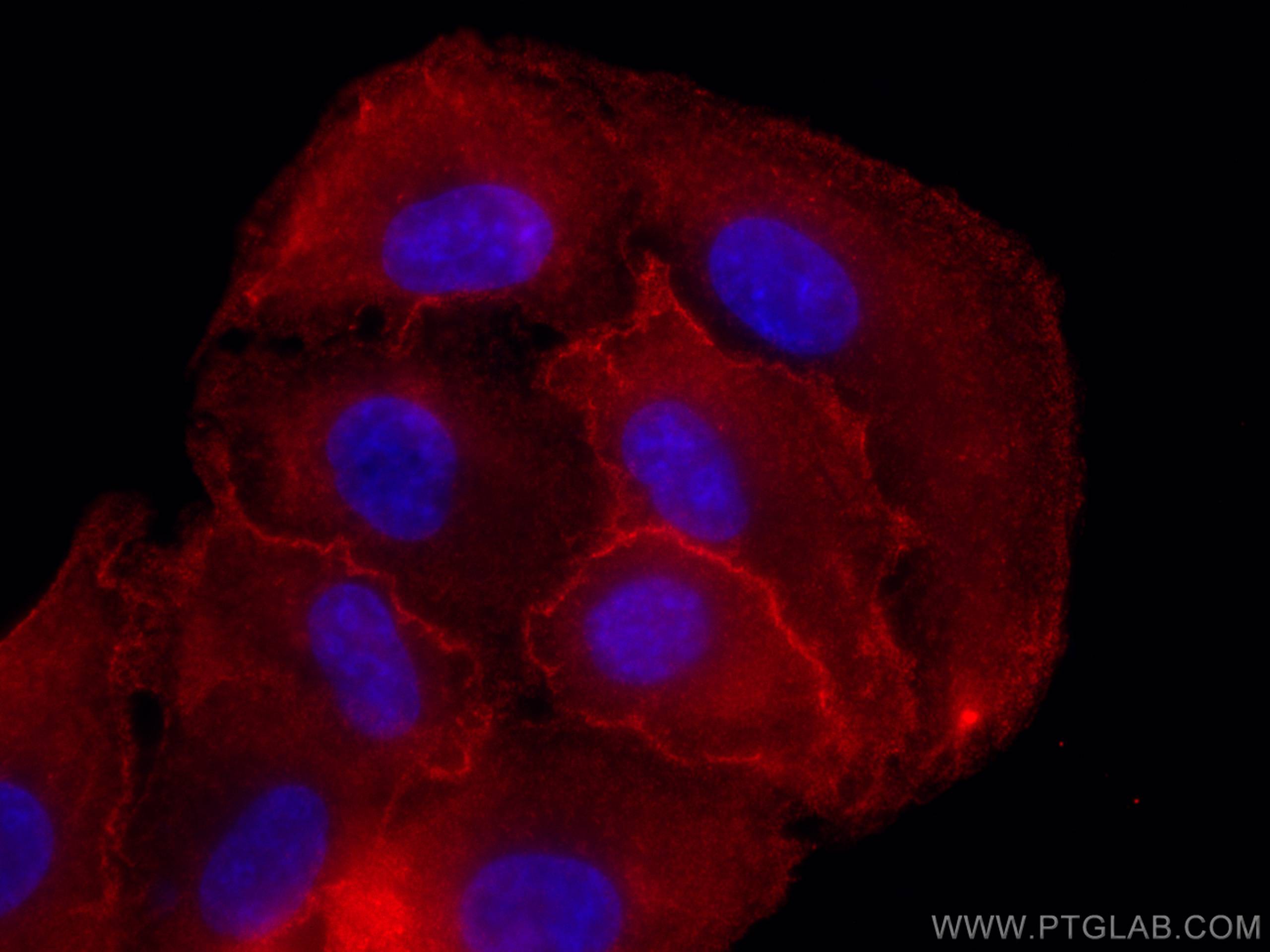 Immunofluorescence (IF) / fluorescent staining of A549 cells using RSPO3 Monoclonal antibody (66314-1-Ig)