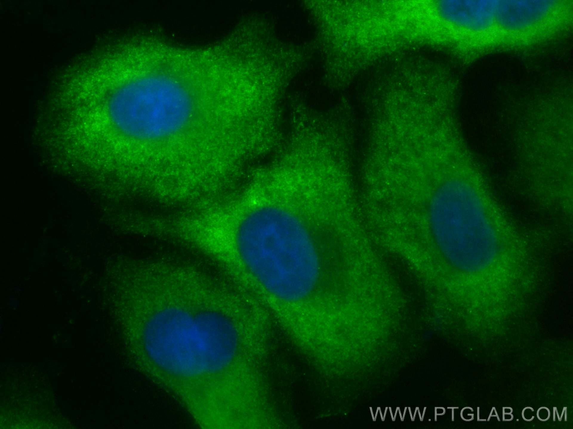 Immunofluorescence (IF) / fluorescent staining of A549 cells using CoraLite® Plus 488-conjugated RSPO3 Monoclonal ant (CL488-66314)