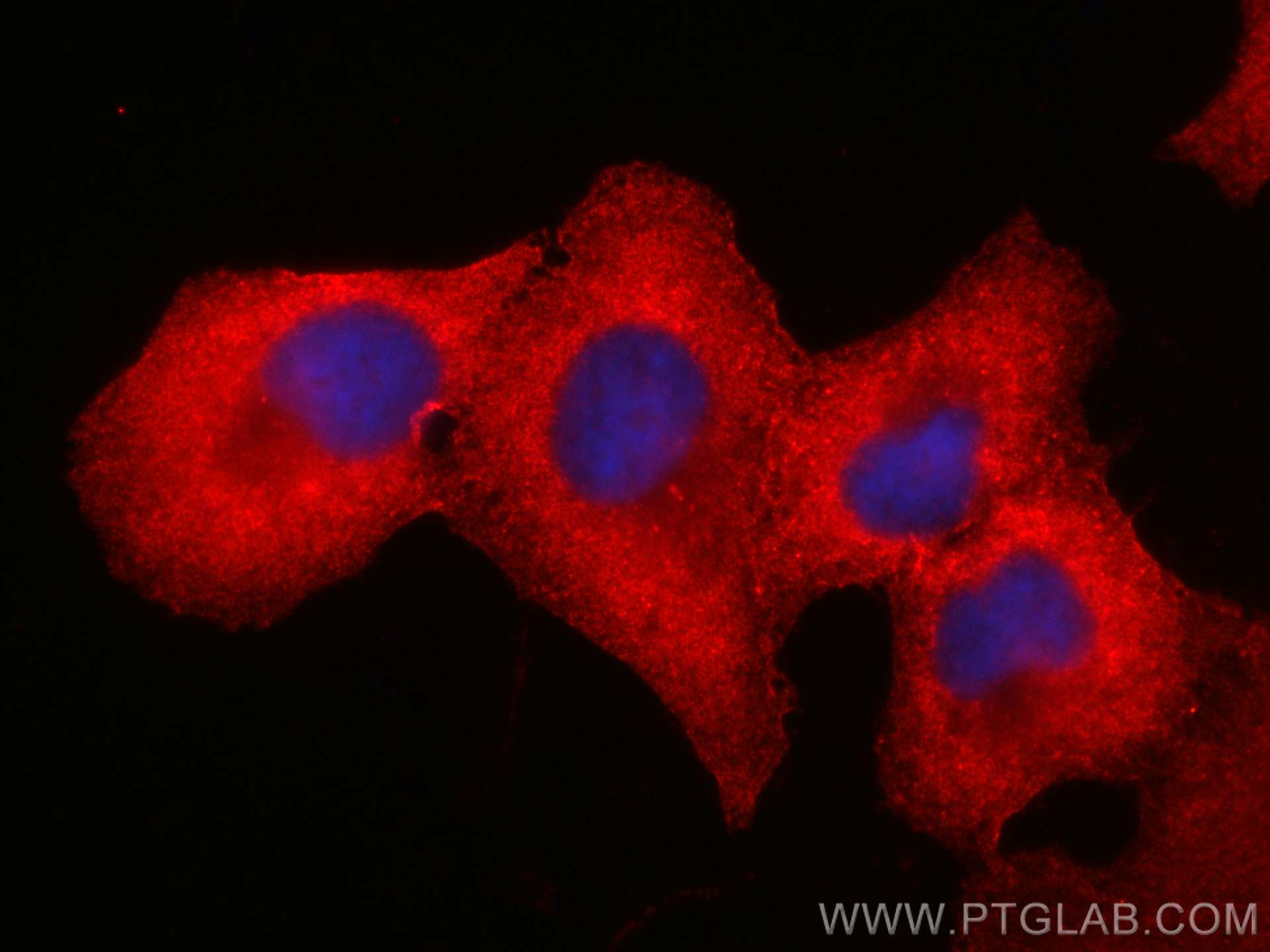 Immunofluorescence (IF) / fluorescent staining of A549 cells using CoraLite®594-conjugated RSPO3 Monoclonal antibody (CL594-66314)