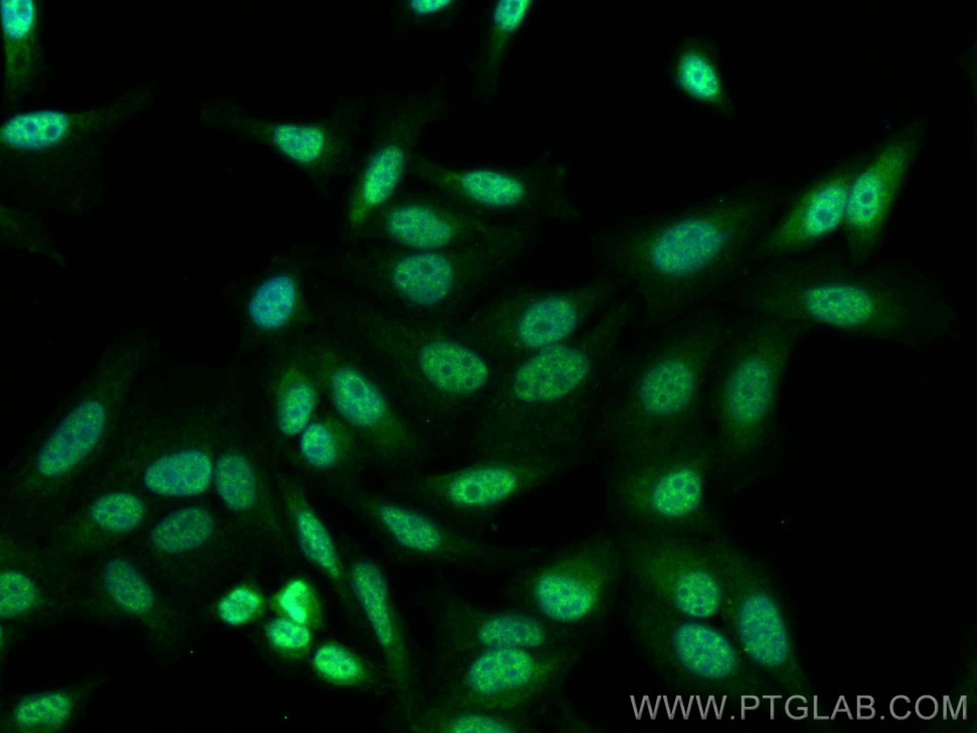 Immunofluorescence (IF) / fluorescent staining of HepG2 cells using RSRC1 Polyclonal antibody (23826-1-AP)