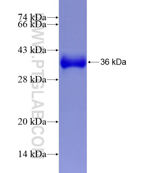 RSRC2 fusion protein Ag29139 SDS-PAGE