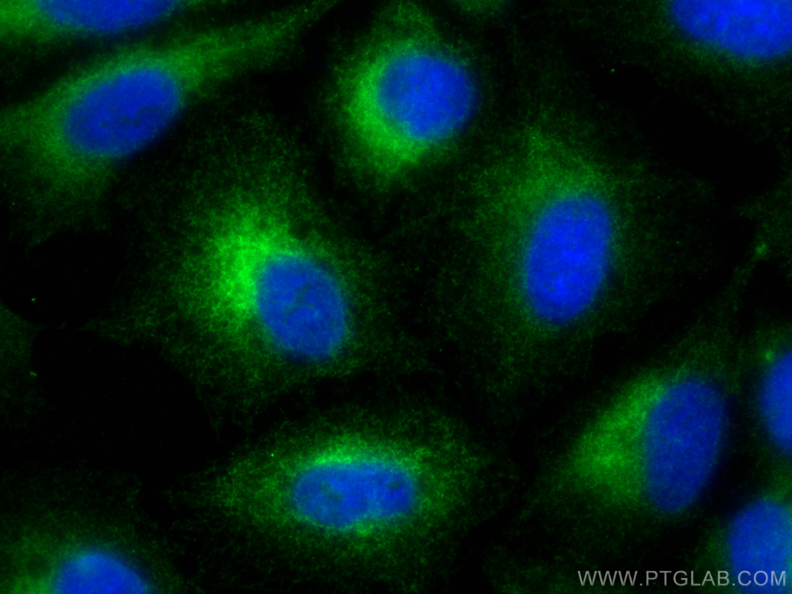 Immunofluorescence (IF) / fluorescent staining of A549 cells using RTN4/NOGO Polyclonal antibody (10740-1-AP)