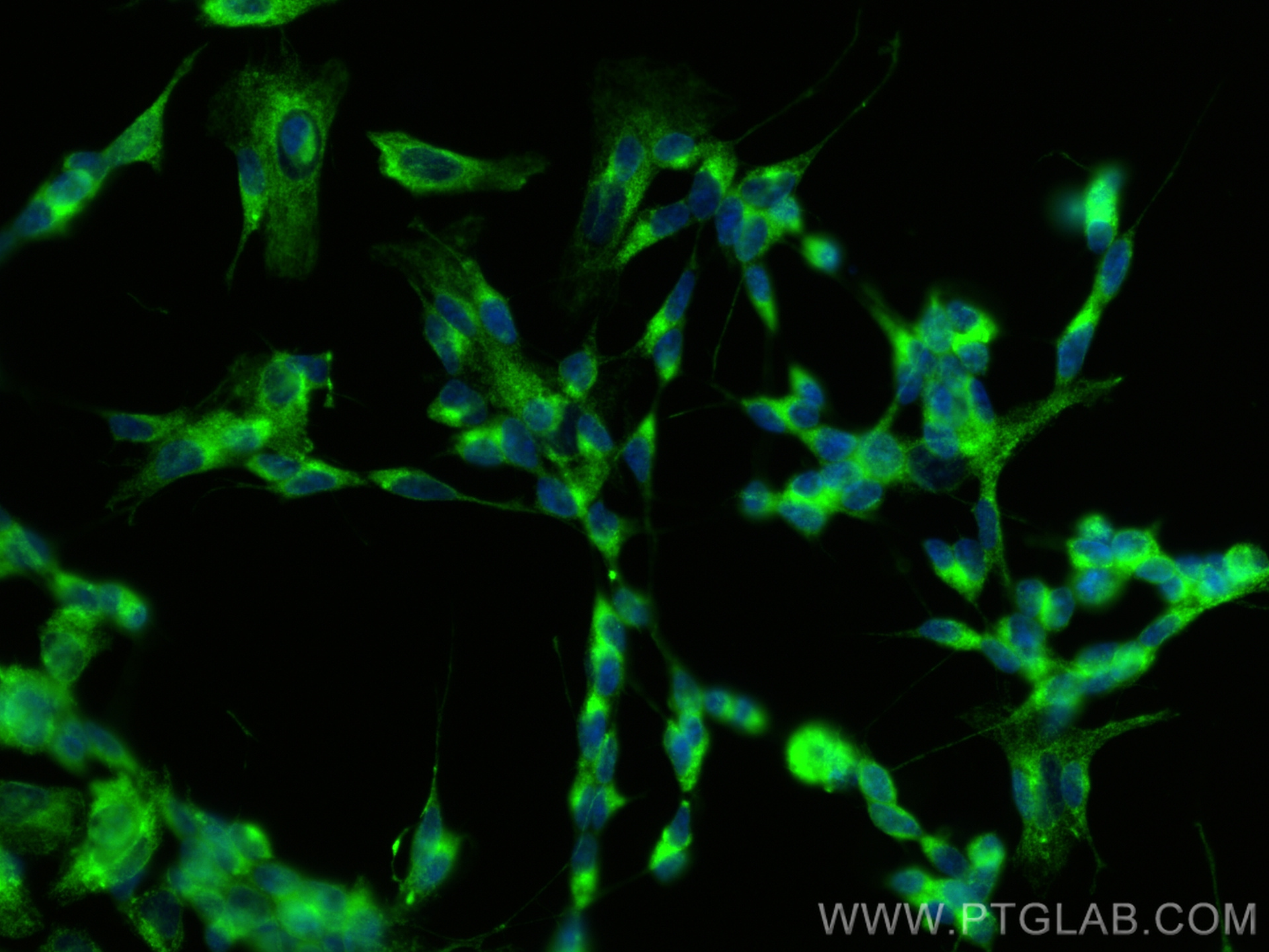 Immunofluorescence (IF) / fluorescent staining of SH-SY5Y cells using RTN4/NOGO Polyclonal antibody (10950-1-AP)