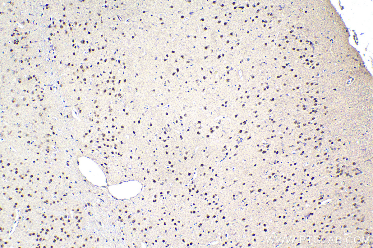 Immunohistochemistry (IHC) staining of mouse brain tissue using RUNX1T1 Polyclonal antibody (15494-1-AP)