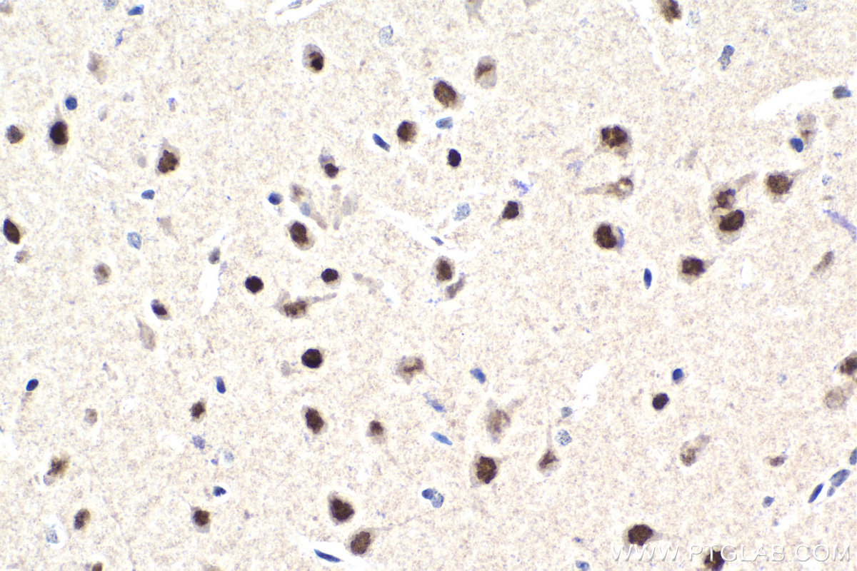 Immunohistochemistry (IHC) staining of mouse brain tissue using RUNX1T1 Polyclonal antibody (15494-1-AP)