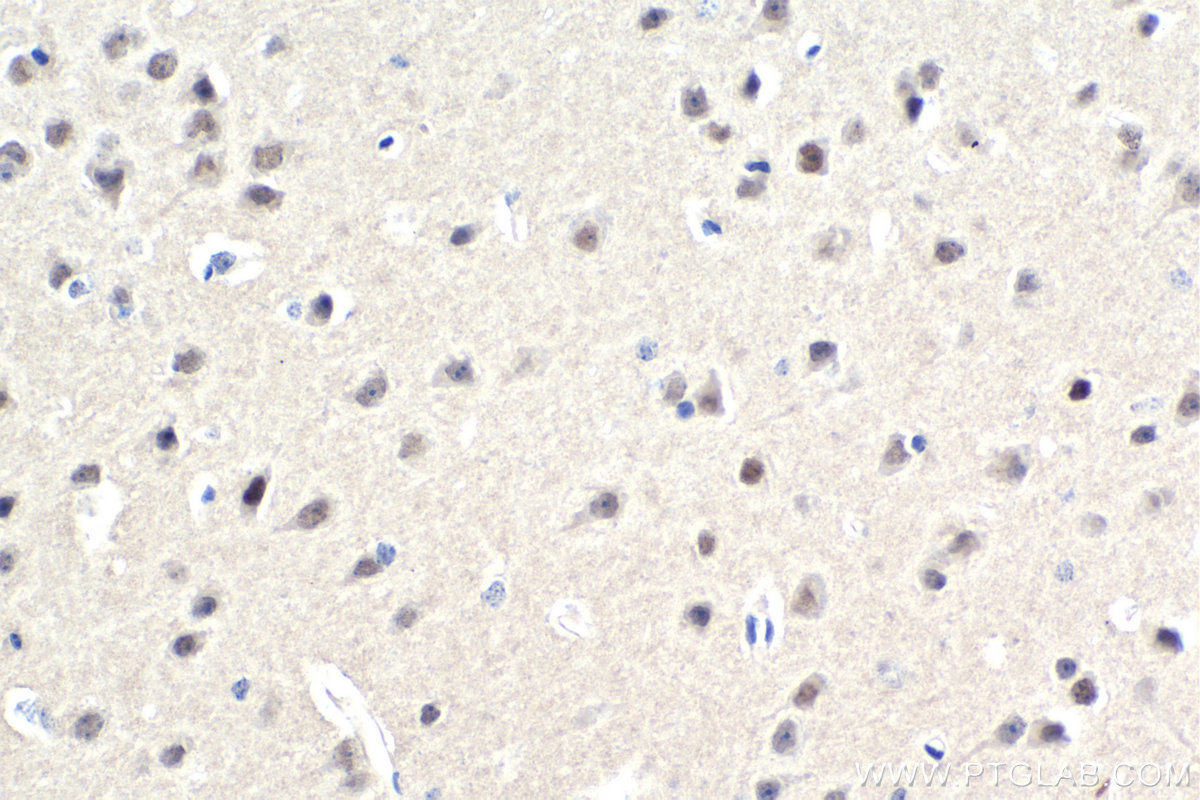 Immunohistochemistry (IHC) staining of mouse brain tissue using RUNX1T1 Monoclonal antibody (67086-1-Ig)