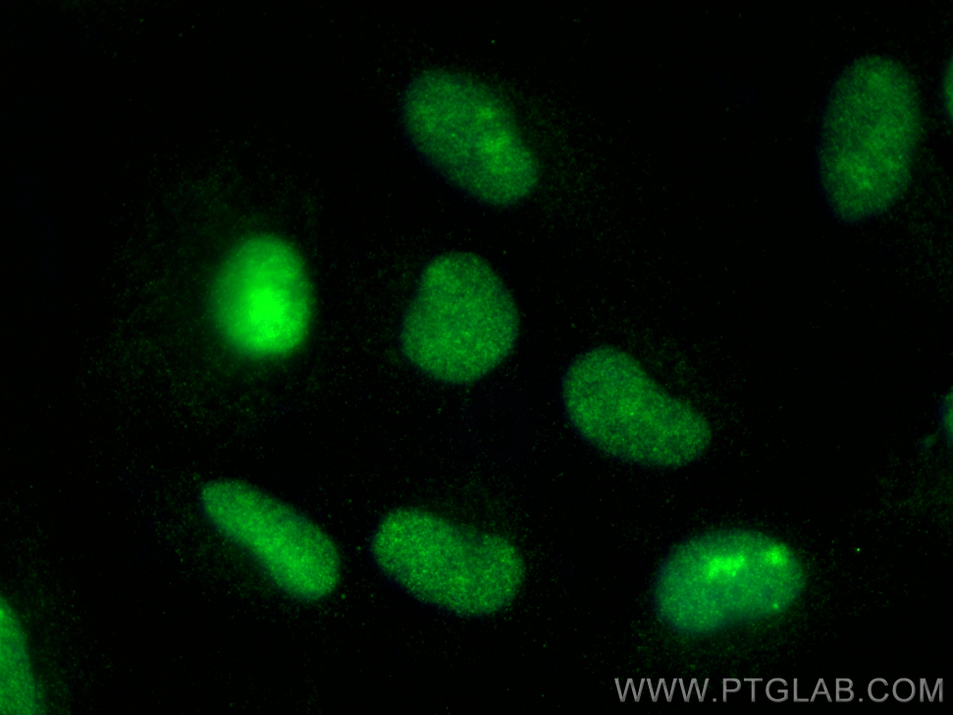 Immunofluorescence (IF) / fluorescent staining of ROS1728 cells using RUNX2 Polyclonal antibody (20700-1-AP)