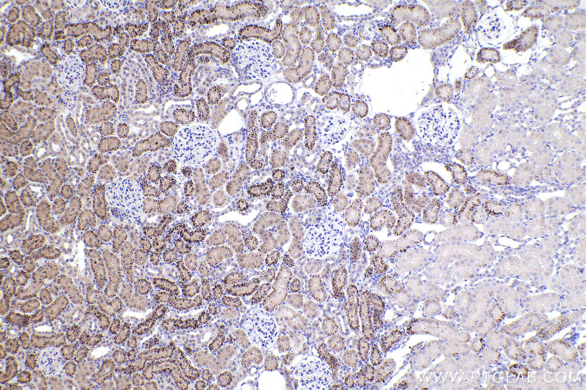 Immunohistochemistry (IHC) staining of rat kidney tissue using RUNX2 Polyclonal antibody (20700-1-AP)