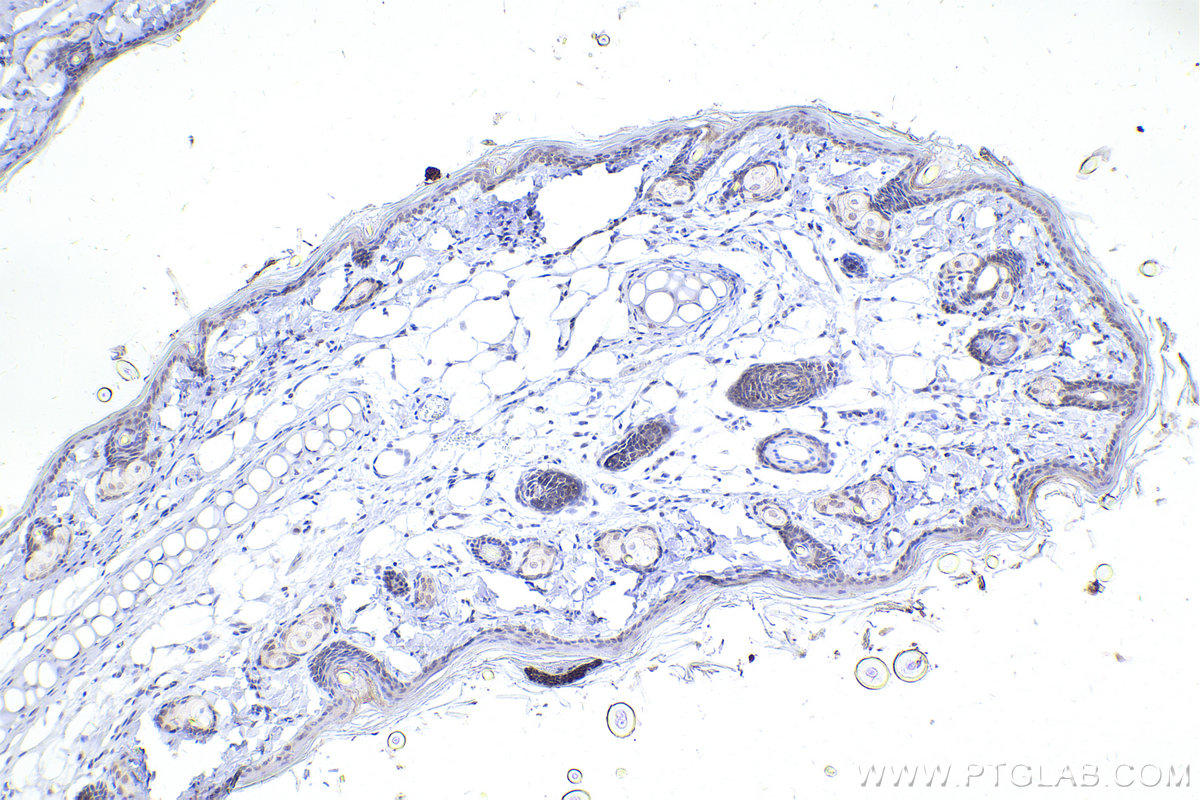 Immunohistochemistry (IHC) staining of rat skin tissue using RUNX2 Polyclonal antibody (20700-1-AP)