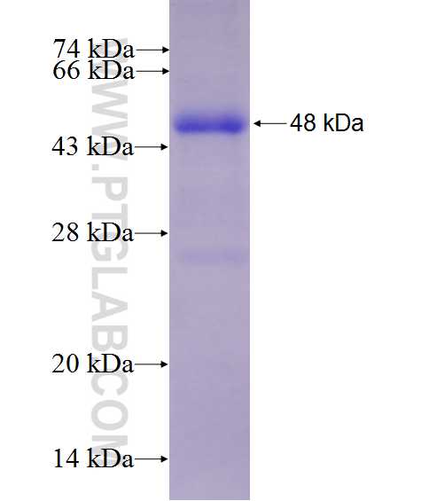 RWDD2B fusion protein Ag27126 SDS-PAGE