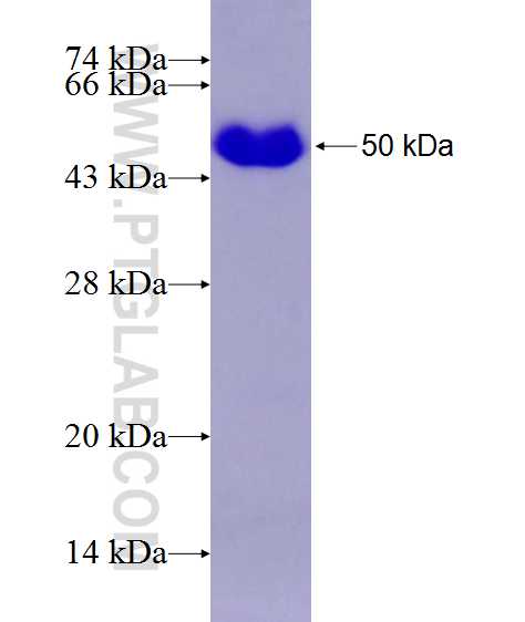 RWDD2B fusion protein Ag27181 SDS-PAGE