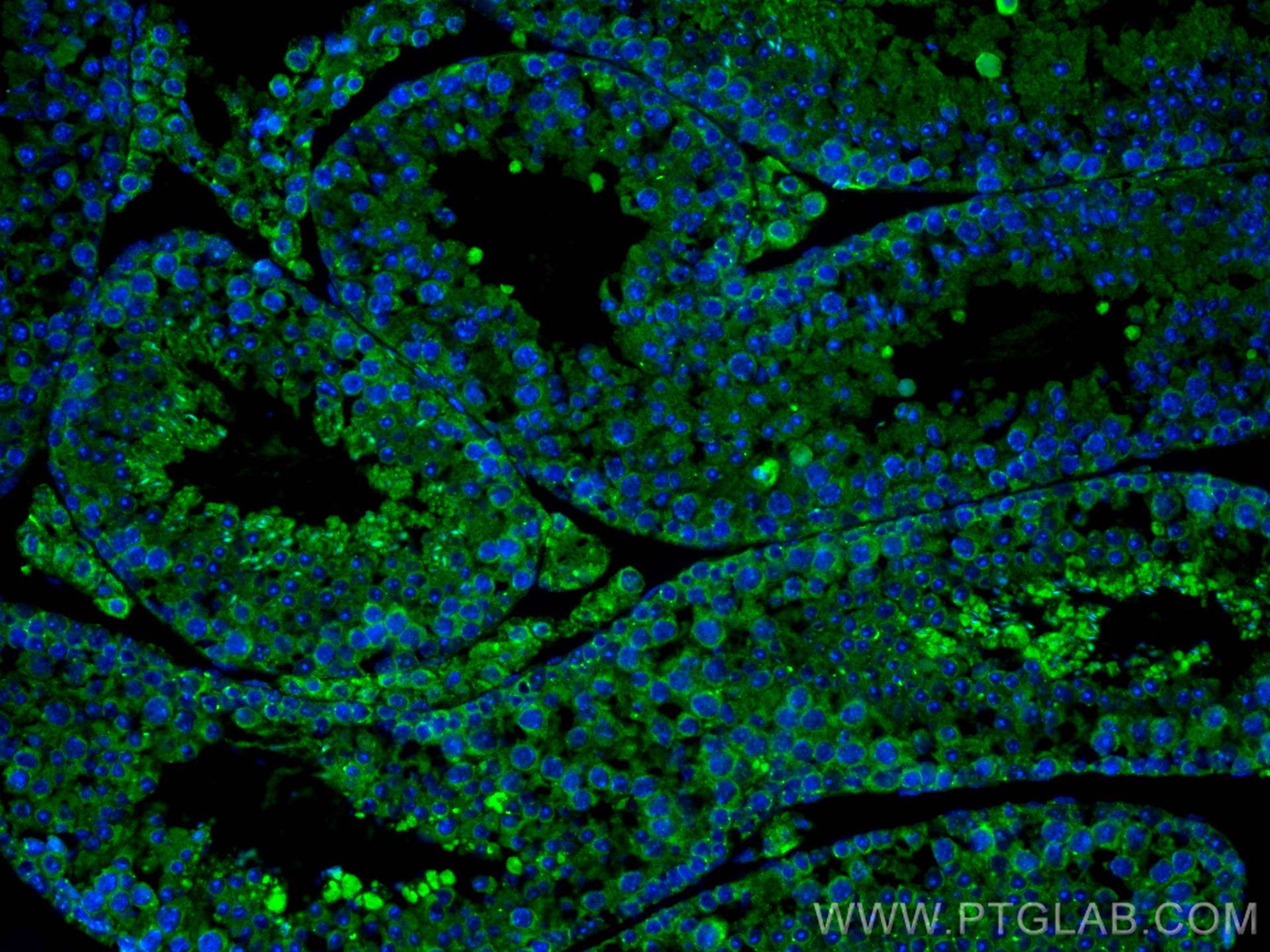 Immunofluorescence (IF) / fluorescent staining of mouse testis tissue using RXFP1 Polyclonal antibody (18419-1-AP)