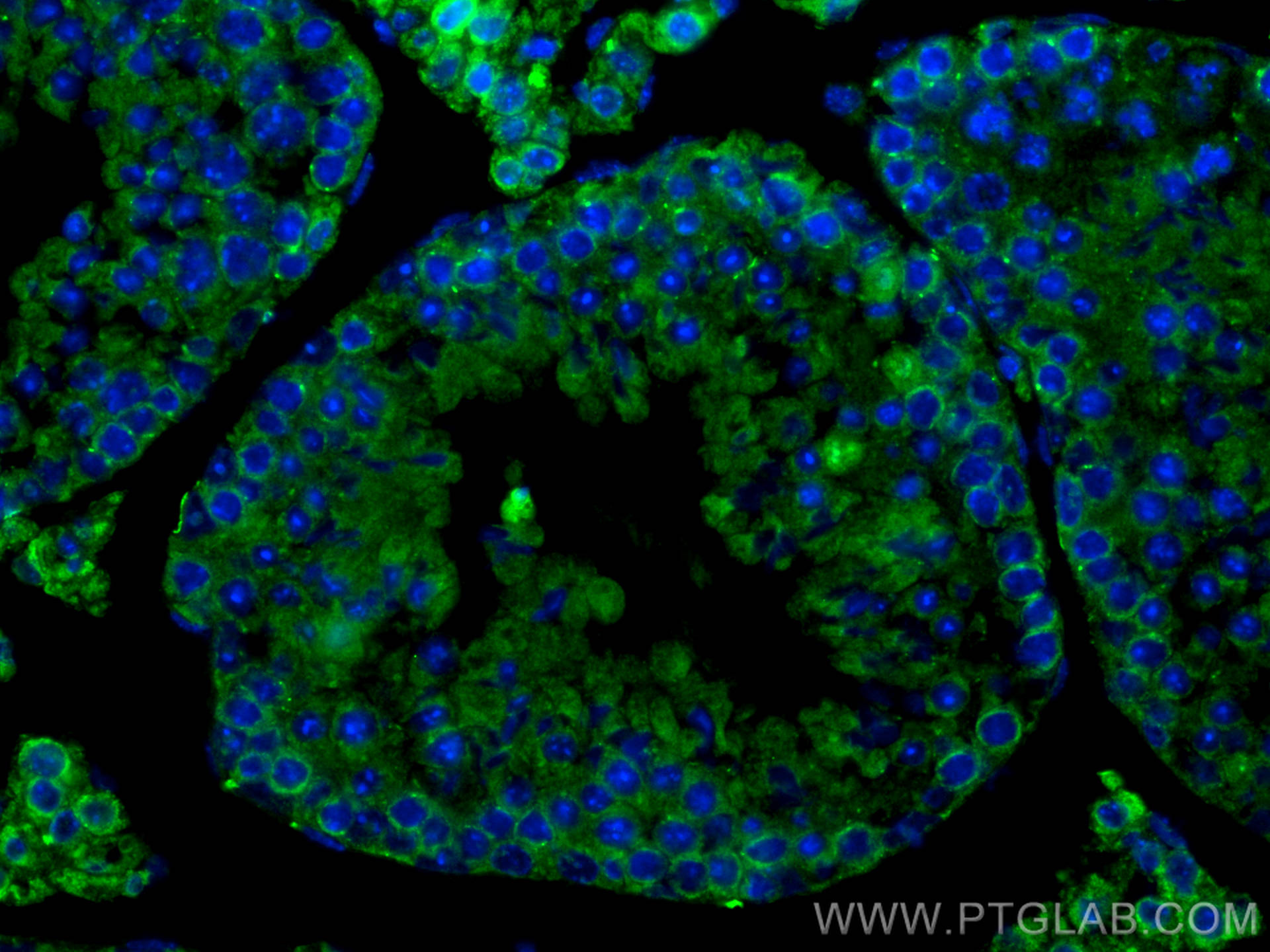 Immunofluorescence (IF) / fluorescent staining of mouse testis tissue using RXFP1 Polyclonal antibody (18419-1-AP)