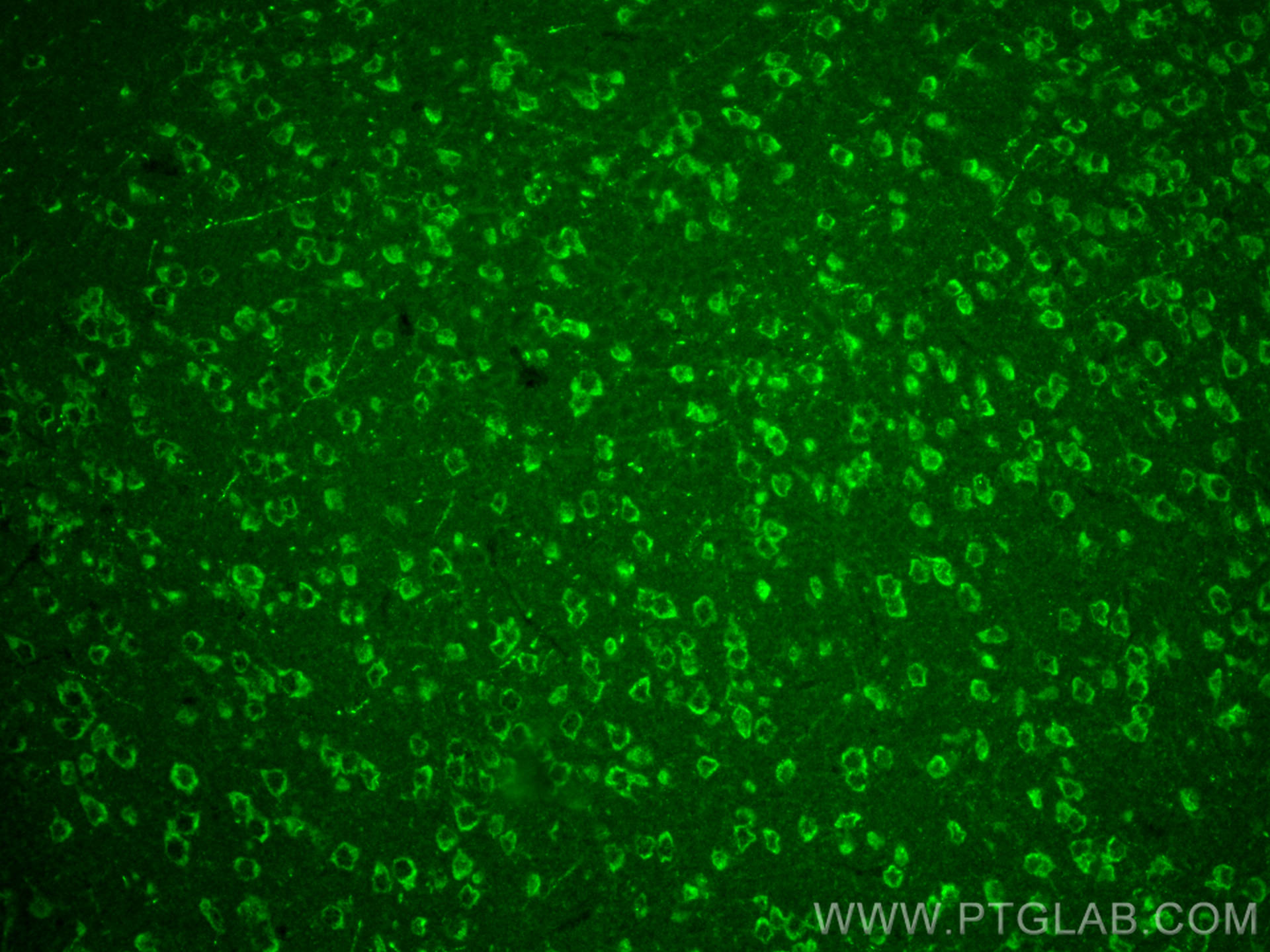 Immunofluorescence (IF) / fluorescent staining of mouse brain tissue using RXFP1 Polyclonal antibody (18419-1-AP)