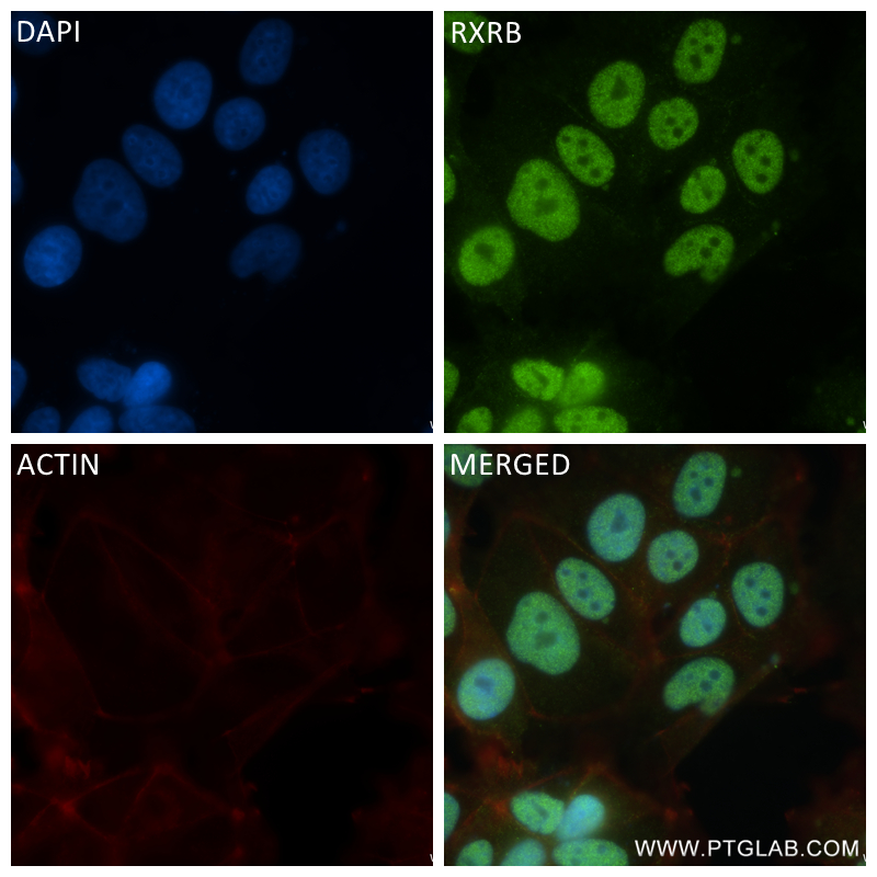 Immunofluorescence (IF) / fluorescent staining of MCF-7 cells using RXRB Recombinant antibody (84656-4-RR)