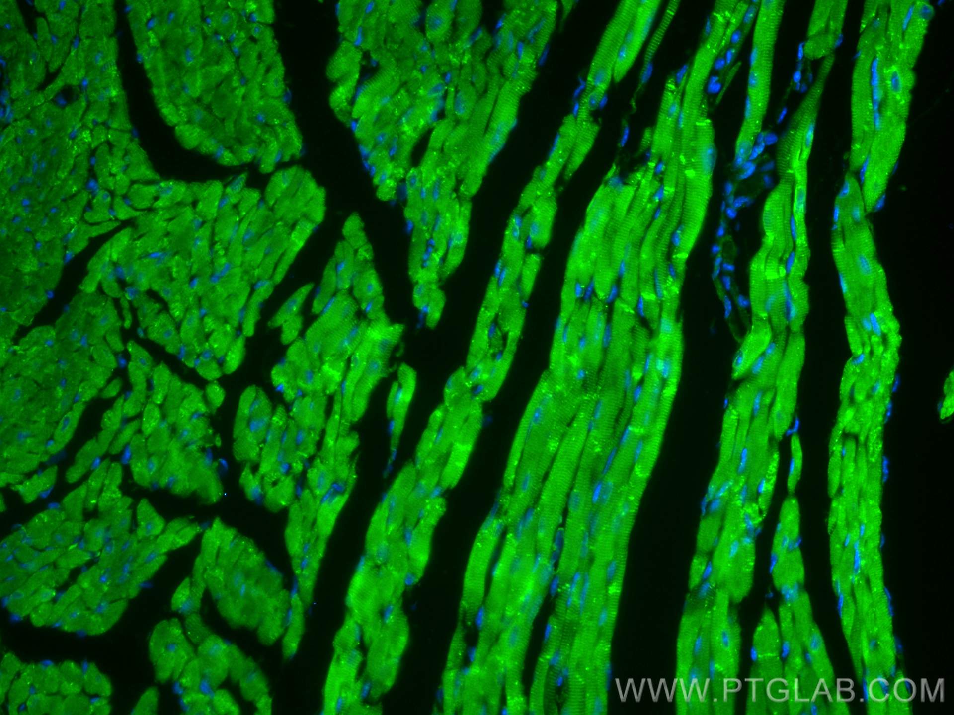 Immunofluorescence (IF) / fluorescent staining of mouse heart tissue using RYR2 Polyclonal antibody (19765-1-AP)