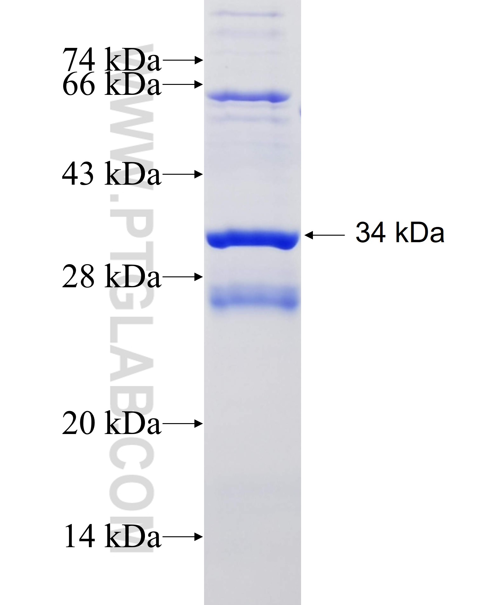 RYR3 fusion protein Ag25978 SDS-PAGE