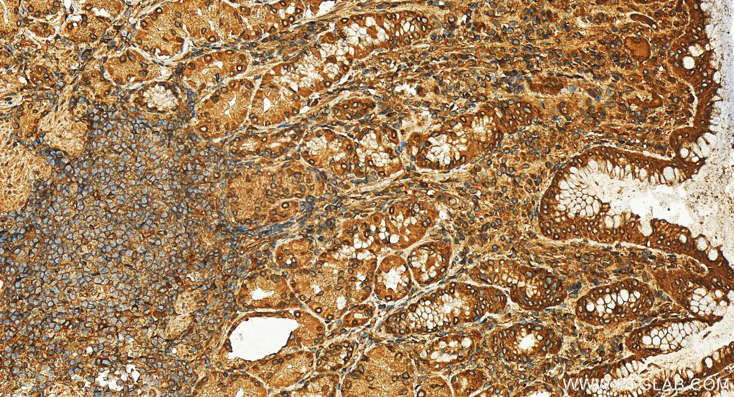 Immunohistochemistry (IHC) staining of human stomach tissue using RanGAP1 Polyclonal antibody (27405-1-AP)