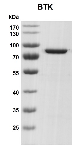 Recombinant BTK protein | Proteintech