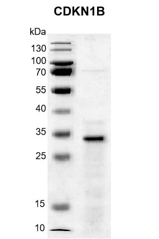 Recombinant CDKN1B protein 12.5% SDS-PAGE Coomassie staining M.W.: 24.01 kDa Purity: ≥ 80%