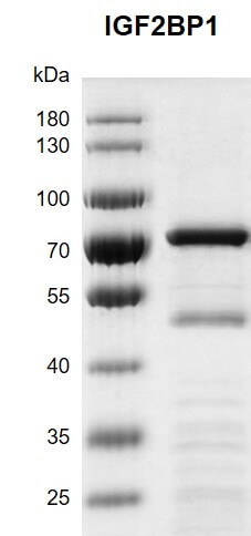 Recombinant IGF2BP1 protein gel 10% SDS-PAGE with Coomassie blue staining MW: 64.8 kDa Purity: >78%