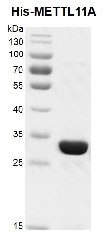 Recombinant METTL11A / NTMT1, His-tag , protein gel 12.5% SDS-PAGE Coomassie staining MW: 28.9 kDa Purity: >95% 	